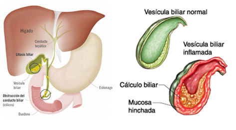 Vesicula